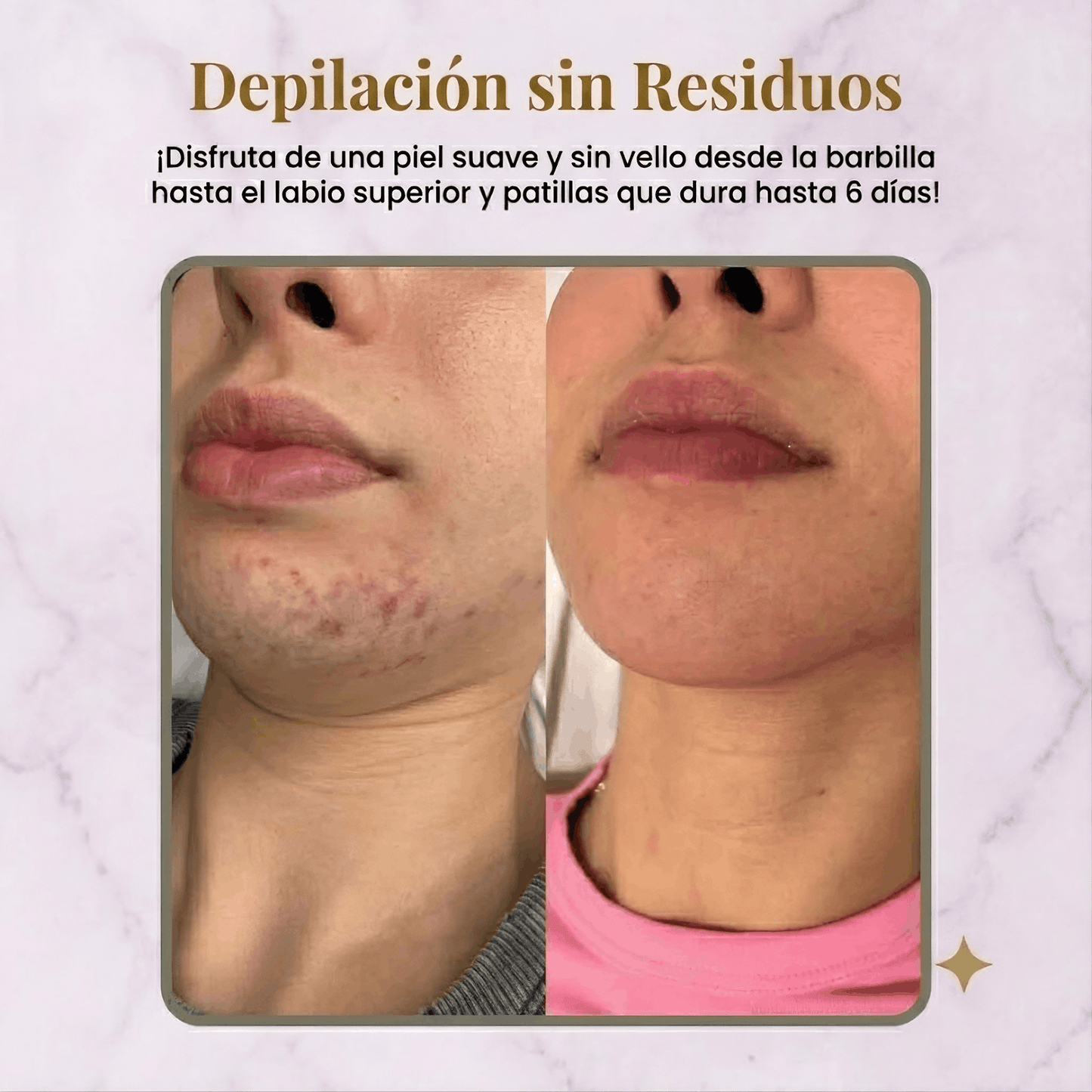 Rostro Liso